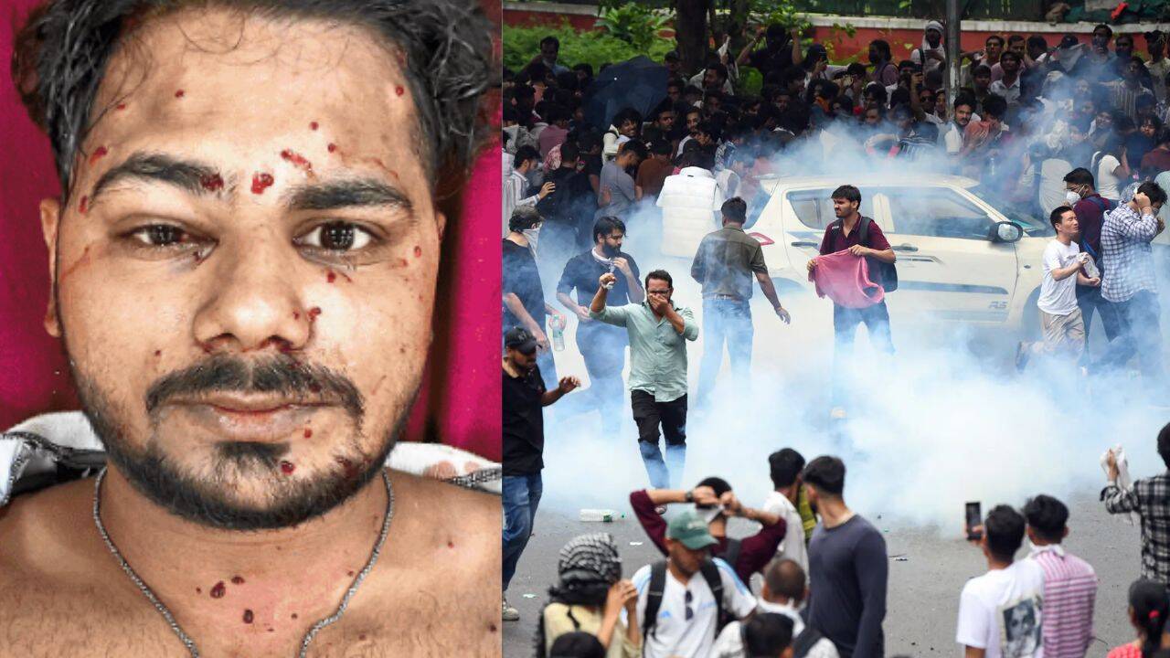 CJP Protester Hit by Pellet Gun Fire Near Jantar Mantar
