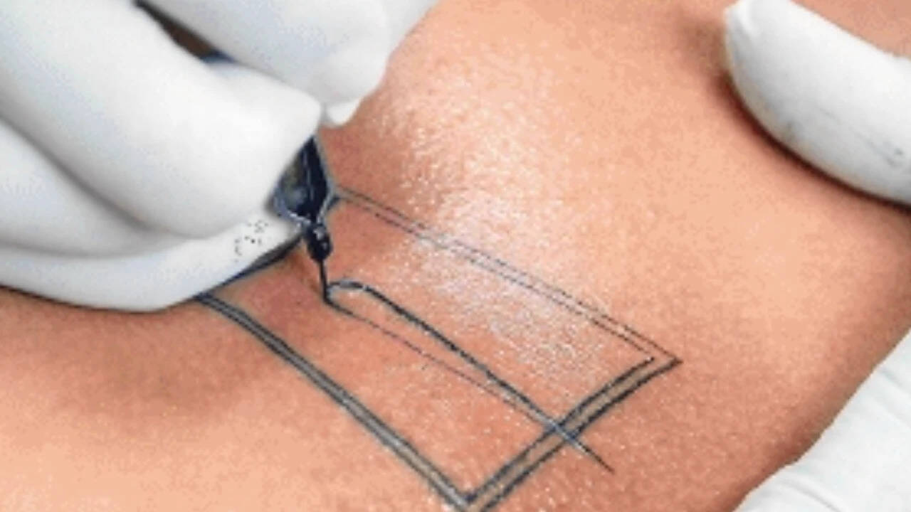 Woman Contracts HIV After Tattoo