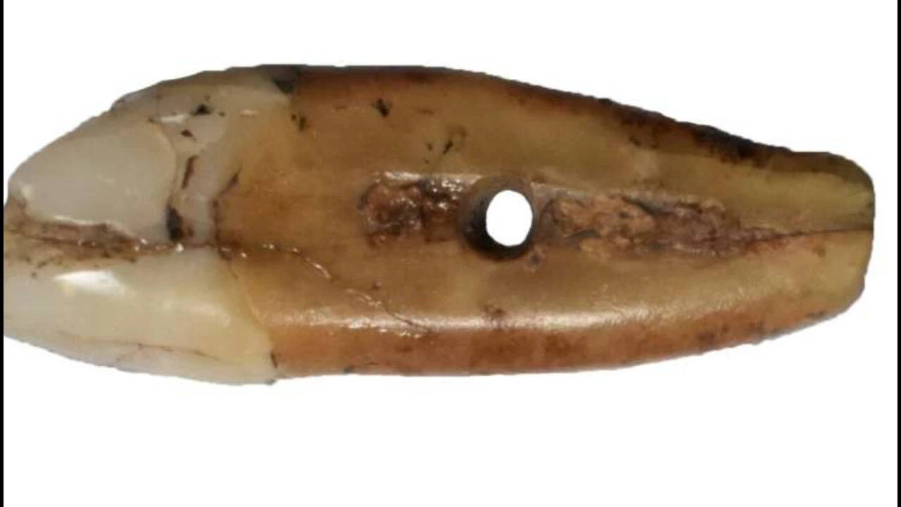 6,500-year-old tooth found in Serbia