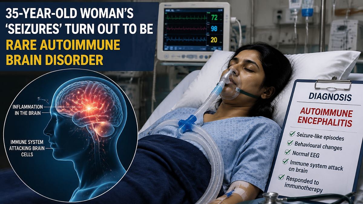 Thane Woman Diagnosed With Rare Autoimmune Encephalitis At KIMS Hospitals