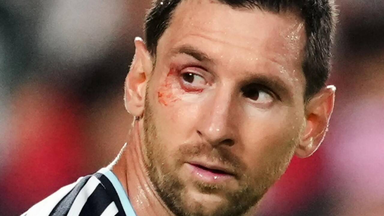 Argentina Beats Switzerland