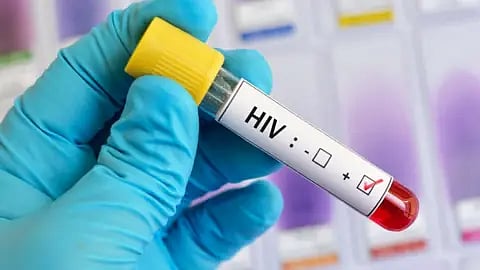 Experimental HIV Vaccine Shows Promise
