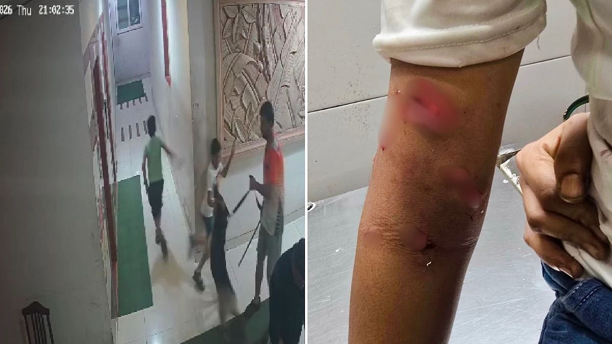 Pet Dog Bites Child in Kalyan Society